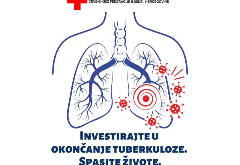 Crveni križ FBiH obilježava Tjedan borbe protiv tuberkuloze